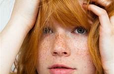 freckles sommersprossen ginger redheads sollis rote rotblonde heads presenting pelirroja pecas rothaarige gemerkt