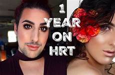 mtf hrt timeline transgender surgery year