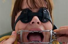 dentist kink gags dearmond cruel lundis daltor braces submission cuffs