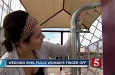 finger loses ring wedding caught her fence woman when gets