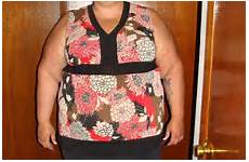 mother obese weight her mum skin wendy rid now therapy chance removal 2nd illinois life but epperly miller after shed