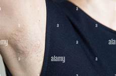 hairy armpit female girl closeup care stock close unshaven body alamy white