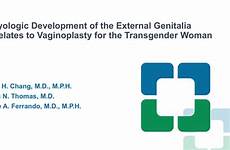 vaginoplasty genitalia transgender relates embryologic
