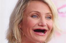 teeth without celebrities cameron stars diaz celebs sans celebrity smile dents mouth people star pearly whites their missing who rotting