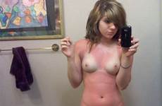 sunburnt selfies