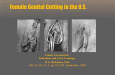 circumcision female islam fgm result
