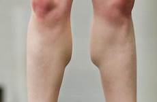 calves legs muscle her ballerina