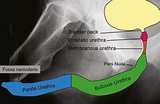 urethra bladder male urethrogram segments retrograde radiology ureters anatomic demonstrates superimposed figure illustration radiologykey