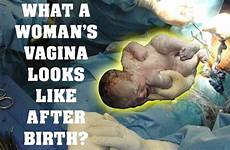 birth vaginas childbirth twink