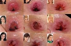ass hole assholes gaping collage star name butthole gape anal pf tumblr anyone them faces granny big eporner sex fuck