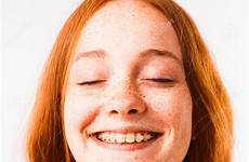 braces freckles emotional sproeten portret steunen emotioneel witte