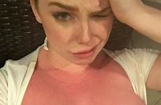 boobs sophie sunburnt coady eporner amateur selfie