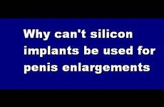 penis enlargement implants silicon