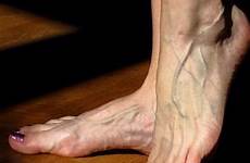 feet veiny large