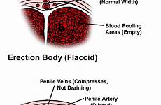erection weak ejaculation erectile dysfunction causes normal premature penis anatomy low process cause men if impotence pills emedicinehealth treatment larger