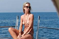 hervey ischia flashes middleton sunbathing celebrityslips