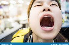 mouth wide girl asian opening her dreamstime person young preview