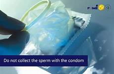 condom collect semen