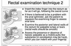 rectal examination