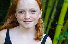 ginger chested freckels freckles redheads foley