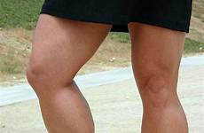 calves muscular muscle