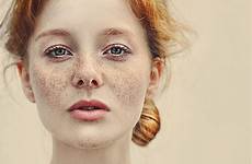 freckles 500px