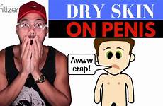 penis skin dry peeling causes