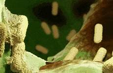xanthomonas microbiology biology bacteria secretion inventos junkie humanos seres usan bacterial