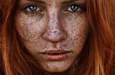 freckles redheads freckled fascinating sommersprossen freckle greenorc venja