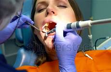 dentist drilled