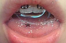 brackets dientes saliva designspiration brace