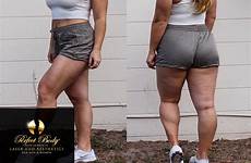 cellulite thighs loss buttocks