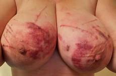 tits tumbex torture