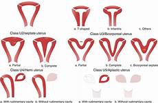 genital female tract development abnormal surgical correction anomalies vagina malformation surgery uterus fig eshre atlas ed 1st
