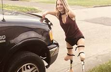 amputee limbless tumbex legless cripple cripples dak