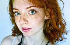 freckle freckles redheads