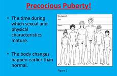 puberty precocious