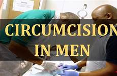 circumcision men