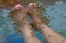 fish pedicure feet woman toenails off after eating skin started got fall she report