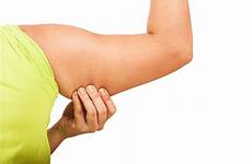 arms gordo gordura isolado axila mostram flabby perder corporal livestrong exercises braço clothes cellulite