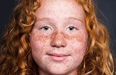 freckles chubby redheads
