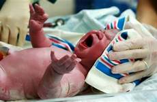 vagina baby head inside delivery birth nurse held stop previous