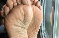 soles wrinkles deep canady
