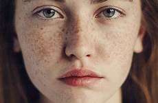 face close freckles girl beautiful