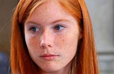 freckles redheads woman braces heads freckle 2folie beleza headed kastanjebruin refrence mostly gingers redhair corps regard rood sommersprossen 24th