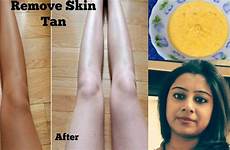 tan removal body sun remove