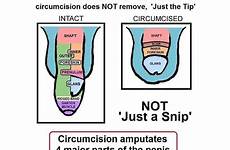 circumcision unkindest circumcise freshmag