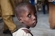 starving nigerian boko haram suffering glued malnutrition clinic sits unicef settlement displaced internally acute severe