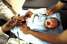 circumcision human circumcised care
