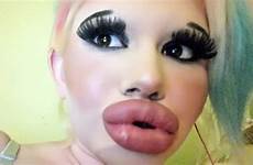 filler procedures kali suntik bulgaria triple spends ivanova pout bibir terbesar ingin punya wanita